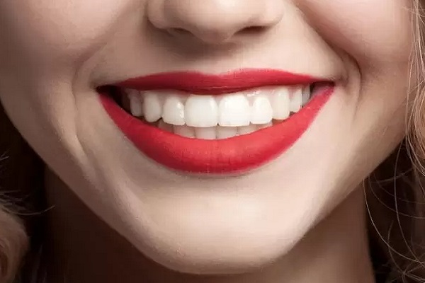 6----hollywood-smile